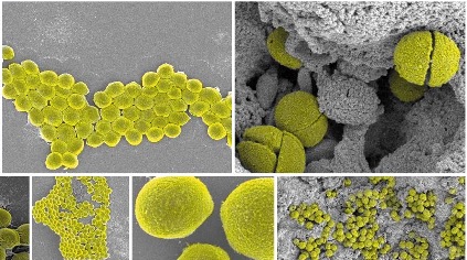 Methicillin resistant Staphylococcus aureus (MRSA), one of the most common human bacterial pathogens.
